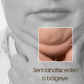 Çene altı bölgesine özel uygulama — RL Beauty Lounge Instagram gönderisi