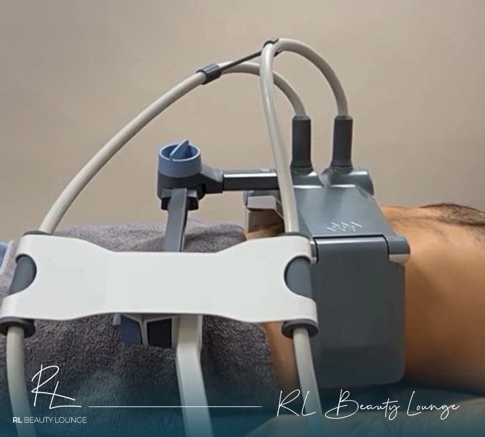 BTL Vanquish ME cihazı — temassız radyofrekans başlığı, RL Beauty Lounge Ankara